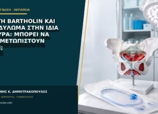 Κύστη Bartholin και κονδύλωμα στην ίδια πλευρά: μπορεί να αντιμετωπιστούν μαζί; Κύστη Bartholin και κονδύλωμα στην ίδια πλευρά: μπορεί να αντιμετωπιστούν μαζί;