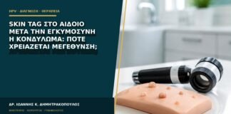 Skin tag στο αιδοίο μετά την εγκυμοσύνη ή κονδύλωμα: πότε χρειάζεται μεγέθυνση;