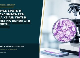 Fordyce spots ή κονδυλώματα στα μικρά χείλη: γιατί η συμμετρία βοηθά στη διάγνωση; Fordyce spots ή κονδυλώματα στα μικρά χείλη: γιατί η συμμετρία βοηθά στη διάγνωση;