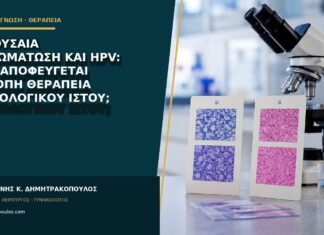 Αιθουσαία θηλωμάτωση και HPV: πώς αποφεύγεται άσκοπη θεραπεία φυσιολογικού ιστού; Αιθουσαία θηλωμάτωση και HPV: πώς αποφεύγεται άσκοπη θεραπεία φυσιολογικού ιστού;