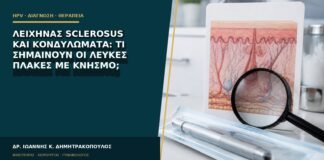 Λειχήνας sclerosus και κονδυλώματα: τι σημαίνουν οι λευκές πλάκες με κνησμό;