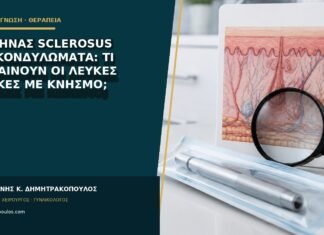 Λειχήνας sclerosus και κονδυλώματα: τι σημαίνουν οι λευκές πλάκες με κνησμό; Λειχήνας sclerosus και κονδυλώματα: τι σημαίνουν οι λευκές πλάκες με κνησμό;