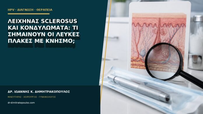 hpv-kondylomata-b85-21 Λειχήνας sclerosus και κονδυλώματα: τι σημαίνουν οι λευκές πλάκες με κνησμό;
