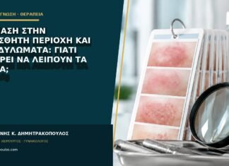 Ψωρίαση στην ευαίσθητη περιοχή και κονδυλώματα: γιατί μπορεί να λείπουν τα λέπια; Ψωρίαση στην ευαίσθητη περιοχή και κονδυλώματα: γιατί μπορεί να λείπουν τα λέπια;