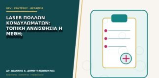 Laser πολλών κονδυλωμάτων: τοπική αναισθησία ή μέθη;
