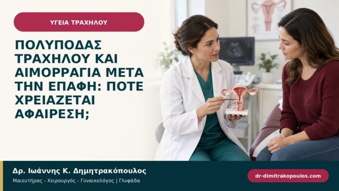 Πολύποδας τραχήλου και αιμορραγία μετά την επαφή: πότε χρειάζεται αφαίρεση; Πολύποδας τραχήλου και αιμορραγία μετά την επαφή: πότε χρειάζεται αφαίρεση;