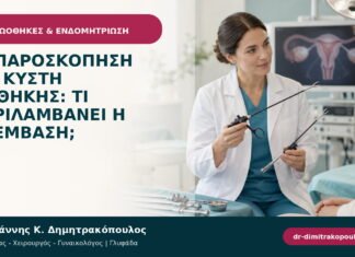 Λαπαροσκόπηση για κύστη ωοθήκης: τι περιλαμβάνει η επέμβαση; Λαπαροσκόπηση για κύστη ωοθήκης: τι περιλαμβάνει η επέμβαση;