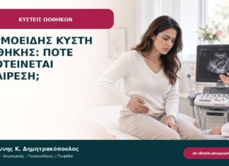 Δερμοειδής κύστη ωοθήκης: πότε προτείνεται αφαίρεση;