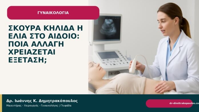Σκούρα κηλίδα ή ελιά στο αιδοίο: ποια αλλαγή χρειάζεται εξέταση; Σκούρα κηλίδα ή ελιά στο αιδοίο: ποια αλλαγή χρειάζεται εξέταση; - Δρ. Ιωάννης Κ. Δημητρακόπουλος