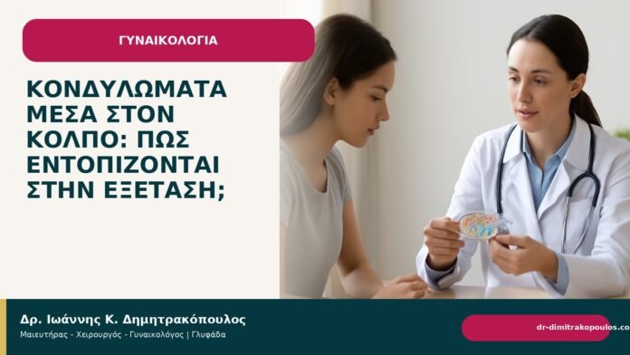 Κονδυλώματα μέσα στον κόλπο: πώς εντοπίζονται στην εξέταση; Κονδυλώματα μέσα στον κόλπο: πώς εντοπίζονται στην εξέταση; - Δρ. Ιωάννης Κ. Δημητρακόπουλος