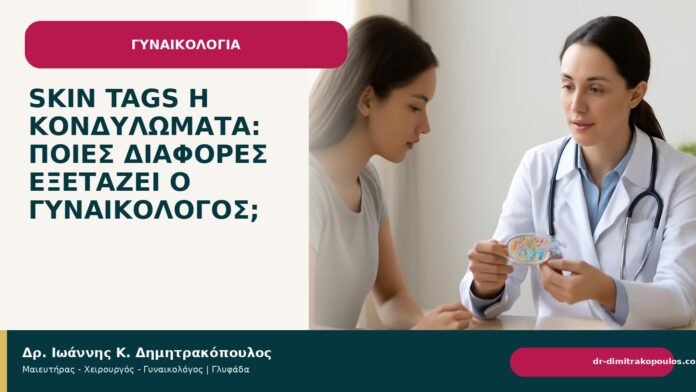 Skin tags ή κονδυλώματα: ποιες διαφορές εξετάζει ο γυναικολόγος; - Δρ. Ιωάννης Κ. Δημητρακόπουλος
