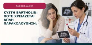Κύστη Bartholin: πότε χρειάζεται απλή παρακολούθηση;