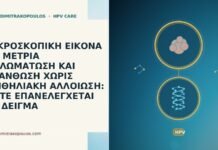 ΜΙΚΡΟΣΚΟΠΙΚΗ ΕΙΚΟΝΑ ΜΕ ΜΕΤΡΙΑ ΘΗΛΩΜΑΤΩΣΗ ΚΑΙ ΑΚΑΝΘΩΣΗ ΧΩΡΙΣ ΕΠΙΘΗΛΙΑΚΗ ΑΛΛΟΙΩΣΗ: