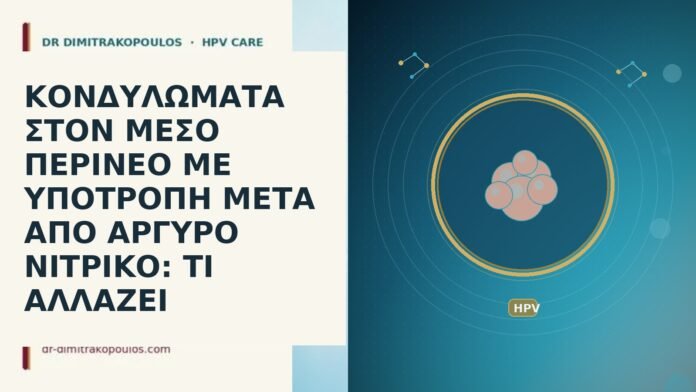 ΚΟΝΔΥΛΩΜΑΤΑ ΣΤΟΝ ΜΕΣΟ ΠΕΡΙΝΕΟ ΜΕ ΥΠΟΤΡΟΠΗ ΜΕΤΑ ΑΠΟ ΑΡΓΥΡΟ ΝΙΤΡΙΚΟ: ΤΙ ΑΛΛΑΖΕΙ ΚΟΝΔΥΛΩΜΑΤΑ ΣΤΟΝ ΜΕΣΟ ΠΕΡΙΝΕΟ ΜΕ ΥΠΟΤΡΟΠΗ ΜΕΤΑ ΑΠΟ ΑΡΓΥΡΟ ΝΙΤΡΙΚΟ: