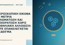 ΜΙΚΡΟΣΚΟΠΙΚΗ ΕΙΚΟΝΑ ΜΕ ΜΕΤΡΙΑ ΘΗΛΩΜΑΤΩΣΗ ΚΑΙ ΔΥΣΚΕΡΑΤΩΣΗ ΧΩΡΙΣ ΕΠΙΘΗΛΙΑΚΗ ΑΛΛΟΙΩΣΗ: ΠΟΤΕ ΕΠΑΝΕΛΕΓΧΕΤΑΙ ΤΟ ΔΕΙΓΜΑ ΜΙΚΡΟΣΚΟΠΙΚΗ ΕΙΚΟΝΑ ΜΕ ΜΕΤΡΙΑ ΘΗΛΩΜΑΤΩΣΗ ΚΑΙ ΔΥΣΚΕΡΑΤΩΣΗ ΧΩΡΙΣ ΕΠΙΘΗΛΙΑΚΗ ΑΛΛΟΙΩΣΗ: