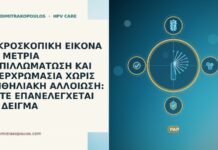 ΜΙΚΡΟΣΚΟΠΙΚΗ ΕΙΚΟΝΑ ΜΕ ΜΕΤΡΙΑ ΠΑΠΙΛΛΩΜΑΤΩΣΗ ΚΑΙ ΥΠΕΡΧΡΩΜΑΣΙΑ ΧΩΡΙΣ ΕΠΙΘΗΛΙΑΚΗ ΑΛΛΟΙΩΣΗ: