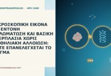ΜΙΚΡΟΣΚΟΠΙΚΗ ΕΙΚΟΝΑ ΜΕ ΕΝΤΟΝΗ ΘΗΛΩΜΑΤΩΣΗ ΚΑΙ ΒΑΣΙΚΗ ΥΠΕΡΠΛΑΣΙΑ ΧΩΡΙΣ ΕΠΙΘΗΛΙΑΚΗ ΑΛΛΟΙΩΣΗ: ΠΟΤΕ ΕΠΑΝΕΛΕΓΧΕΤΑΙ ΤΟ ΔΕΙΓΜΑ ΜΙΚΡΟΣΚΟΠΙΚΗ ΕΙΚΟΝΑ ΜΕ ΕΝΤΟΝΗ ΘΗΛΩΜΑΤΩΣΗ ΚΑΙ ΒΑΣΙΚΗ ΥΠΕΡΠΛΑΣΙΑ ΧΩΡΙΣ ΕΠΙΘΗΛΙΑΚΗ