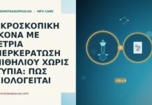 ΜΙΚΡΟΣΚΟΠΙΚΗ ΕΙΚΟΝΑ ΜΕ ΜΕΤΡΙΑ ΥΠΕΡΚΕΡΑΤΩΣΗ ΕΠΙΘΗΛΙΟΥ ΧΩΡΙΣ ΑΤΥΠΙΑ: ΠΩΣ ΑΞΙΟΛΟΓΕΙΤΑΙ ΜΙΚΡΟΣΚΟΠΙΚΗ ΕΙΚΟΝΑ ΜΕ ΜΕΤΡΙΑ ΥΠΕΡΚΕΡΑΤΩΣΗ ΕΠΙΘΗΛΙΟΥ ΧΩΡΙΣ ΑΤΥΠΙΑ: ΠΩΣ ΑΞΙΟΛΟΓΕΙΤΑΙ