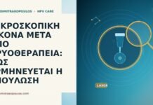 ΜΙΚΡΟΣΚΟΠΙΚΗ ΕΙΚΟΝΑ ΜΕΤΑ ΑΠΟ ΚΡΥΟΘΕΡΑΠΕΙΑ: ΠΩΣ ΕΡΜΗΝΕΥΕΤΑΙ Η ΕΠΟΥΛΩΣΗ ΜΙΚΡΟΣΚΟΠΙΚΗ ΕΙΚΟΝΑ ΜΕΤΑ ΑΠΟ ΚΡΥΟΘΕΡΑΠΕΙΑ: ΠΩΣ ΕΡΜΗΝΕΥΕΤΑΙ Η ΕΠΟΥΛΩΣΗ