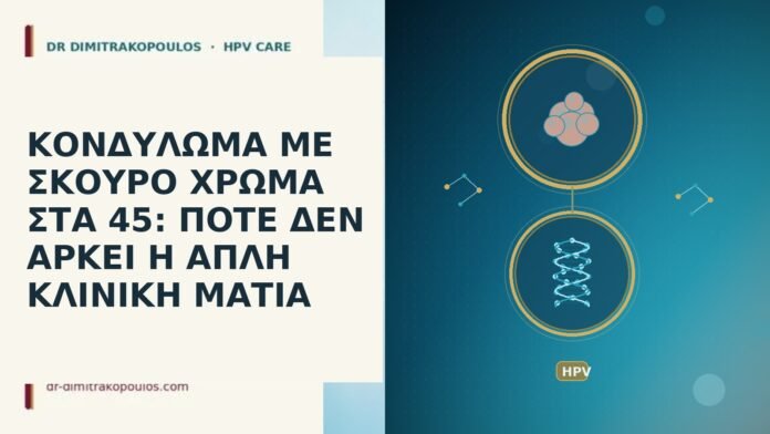 ΚΟΝΔΥΛΩΜΑ ΜΕ ΣΚΟΥΡΟ ΧΡΩΜΑ ΣΤΑ 45: ΠΟΤΕ ΔΕΝ ΑΡΚΕΙ Η ΑΠΛΗ ΚΛΙΝΙΚΗ ΜΑΤΙΑ ΚΟΝΔΥΛΩΜΑ ΜΕ ΣΚΟΥΡΟ ΧΡΩΜΑ ΣΤΑ 45: ΠΟΤΕ ΔΕΝ ΑΡΚΕΙ Η