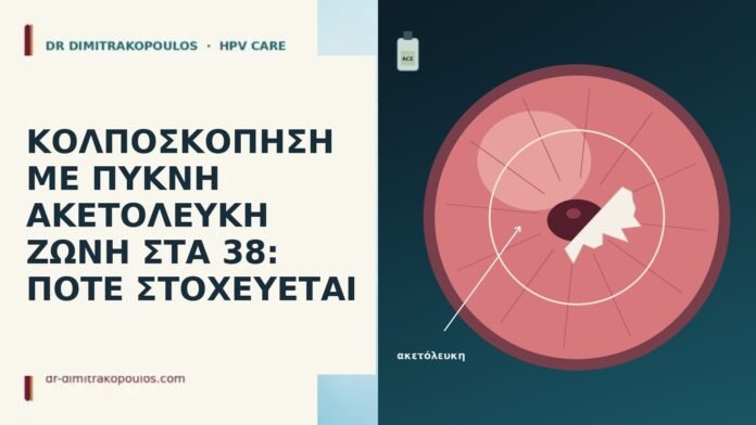 ΚΟΛΠΟΣΚΟΠΗΣΗ ΜΕ ΠΥΚΝΗ ΑΚΕΤΟΛΕΥΚΗ ΖΩΝΗ ΣΤΑ 38: ΠΟΤΕ ΣΤΟΧΕΥΕΤΑΙ