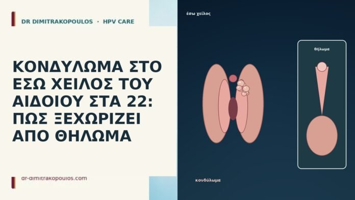 ΚΟΝΔΥΛΩΜΑ ΣΤΟ ΕΣΩ ΧΕΙΛΟΣ ΤΟΥ ΑΙΔΟΙΟΥ ΣΤΑ 22: ΠΩΣ ΞΕΧΩΡΙΖΕΙ