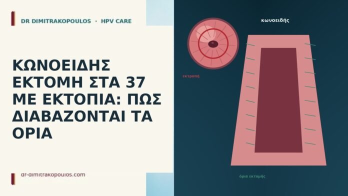 ΚΩΝΟΕΙΔΗΣ ΕΚΤΟΜΗ ΣΤΑ 37 ΜΕ ΕΚΤΟΠΙΑ: ΠΩΣ ΔΙΑΒΑΖΟΝΤΑΙ ΤΑ ΟΡΙΑ ΚΩΝΟΕΙΔΗΣ ΕΚΤΟΜΗ ΣΤΑ 37 ΜΕ ΕΚΤΟΠΙΑ: ΠΩΣ ΔΙΑΒΑΖΟΝΤΑΙ ΤΑ ΟΡΙΑ
