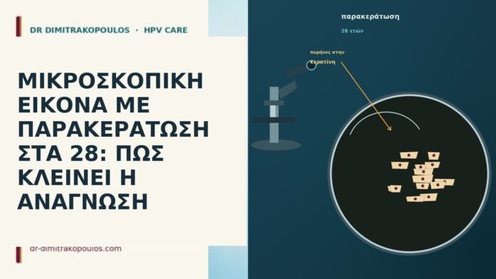 ΜΙΚΡΟΣΚΟΠΙΚΗ ΕΙΚΟΝΑ ΜΕ ΠΑΡΑΚΕΡΑΤΩΣΗ ΣΤΑ 28: ΠΩΣ ΚΛΕΙΝΕΙ Η ΑΝΑΓΝΩΣΗ ΜΙΚΡΟΣΚΟΠΙΚΗ ΕΙΚΟΝΑ ΜΕ ΠΑΡΑΚΕΡΑΤΩΣΗ ΣΤΑ 28: ΠΩΣ ΚΛΕΙΝΕΙ Η ΑΝΑΓΝΩΣΗ