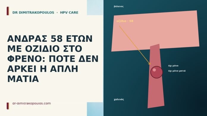 ΑΝΔΡΑΣ 58 ΕΤΩΝ ΜΕ ΟΖΙΔΙΟ ΣΤΟ ΦΡΕΝΟ: ΠΟΤΕ ΔΕΝ ΑΡΚΕΙ Η ΑΠΛΗ ΜΑΤΙΑ ΑΝΔΡΑΣ 58 ΕΤΩΝ ΜΕ ΟΖΙΔΙΟ ΣΤΟ ΦΡΕΝΟ: ΠΟΤΕ ΔΕΝ ΑΡΚΕΙ