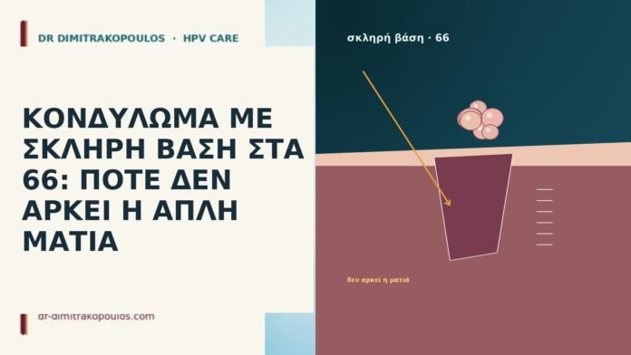 ΚΟΝΔΥΛΩΜΑ ΜΕ ΣΚΛΗΡΗ ΒΑΣΗ ΣΤΑ 66: ΠΟΤΕ ΔΕΝ ΑΡΚΕΙ Η