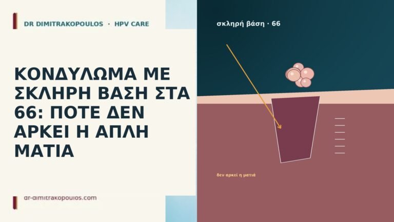ΚΟΝΔΥΛΩΜΑ ΜΕ ΣΚΛΗΡΗ ΒΑΣΗ ΣΤΑ 66: ΠΟΤΕ ΔΕΝ ΑΡΚΕΙ Η