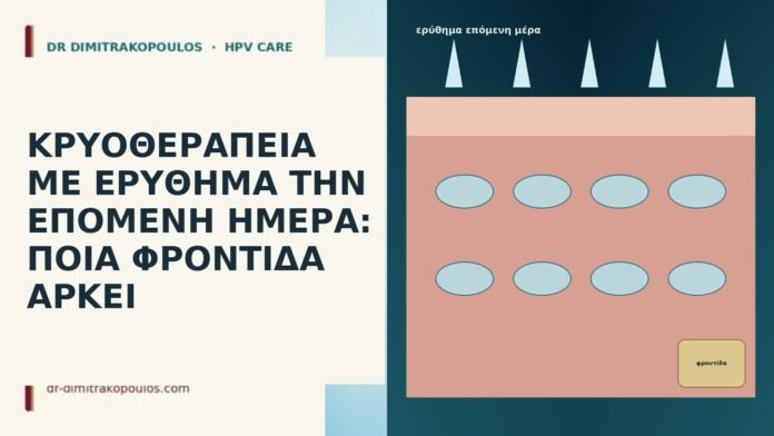 ΚΡΥΟΘΕΡΑΠΕΙΑ ΜΕ ΕΡΥΘΗΜΑ ΤΗΝ ΕΠΟΜΕΝΗ ΗΜΕΡΑ: ΠΟΙΑ ΦΡΟΝΤΙΔΑ ΑΡΚΕΙ