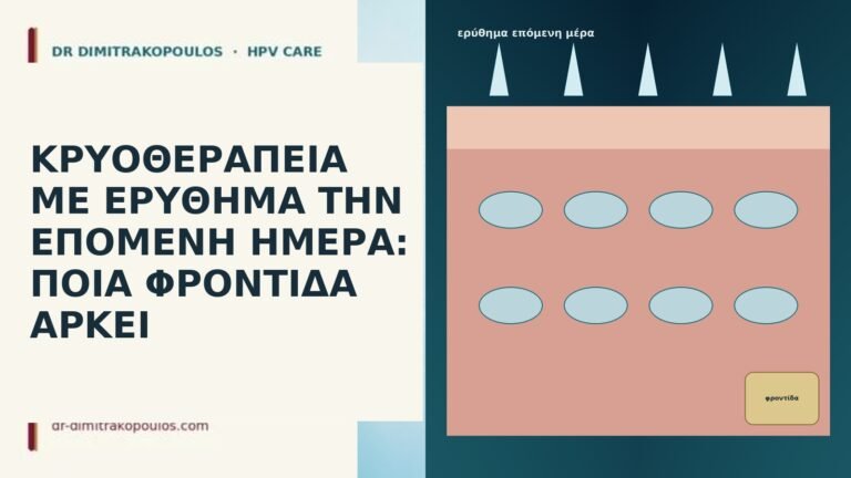 ΚΡΥΟΘΕΡΑΠΕΙΑ ΜΕ ΕΡΥΘΗΜΑ ΤΗΝ ΕΠΟΜΕΝΗ ΗΜΕΡΑ: ΠΟΙΑ ΦΡΟΝΤΙΔΑ ΑΡΚΕΙ