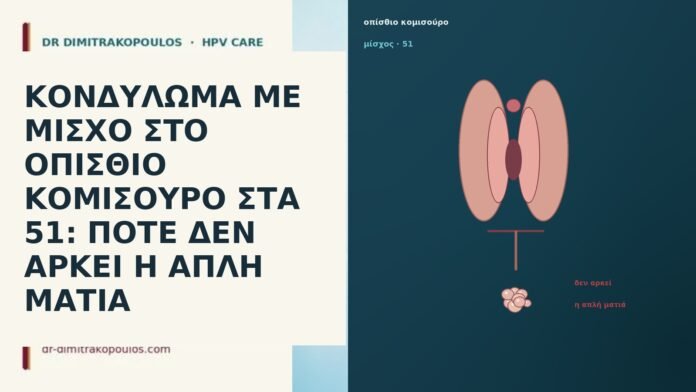 ΚΟΝΔΥΛΩΜΑ ΜΕ ΜΙΣΧΟ ΣΤΟ ΟΠΙΣΘΙΟ ΚΟΜΙΣΟΥΡΟ ΣΤΑ 51: ΠΟΤΕ ΔΕΝ ΑΡΚΕΙ Η ΑΠΛΗ ΜΑΤΙΑ ΚΟΝΔΥΛΩΜΑ ΜΕ ΜΙΣΧΟ ΣΤΟ ΟΠΙΣΘΙΟ ΚΟΜΙΣΟΥΡΟ ΣΤΑ 51: ΠΟΤΕ ΔΕΝ