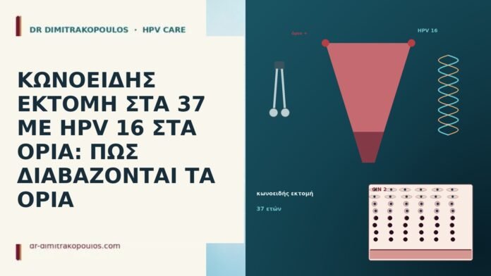 ΚΩΝΟΕΙΔΗΣ ΕΚΤΟΜΗ ΣΤΑ 37 ΜΕ HPV 16 ΣΤΑ ΟΡΙΑ: ΠΩΣ