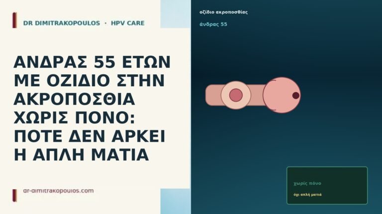 ΑΝΔΡΑΣ 55 ΕΤΩΝ ΜΕ ΟΖΙΔΙΟ ΣΤΗΝ ΑΚΡΟΠΟΣΘΙΑ ΧΩΡΙΣ ΠΟΝΟ: ΠΟΤΕ