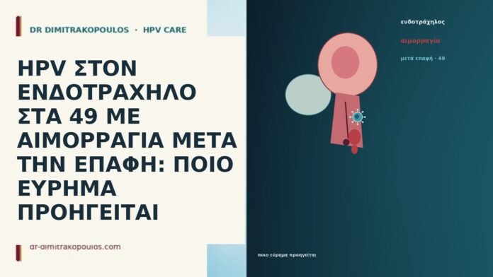 HPV ΣΤΟΝ ΕΝΔΟΤΡΑΧΗΛΟ ΣΤΑ 49 ΜΕ ΑΙΜΟΡΡΑΓΙΑ ΜΕΤΑ ΤΗΝ ΕΠΑΦΗ: ΠΟΙΟ ΕΥΡΗΜΑ ΠΡΟΗΓΕΙΤΑΙ HPV ΣΤΟΝ ΕΝΔΟΤΡΑΧΗΛΟ ΣΤΑ 49 ΜΕ ΑΙΜΟΡΡΑΓΙΑ ΜΕΤΑ ΤΗΝ ΕΠΑΦΗ: