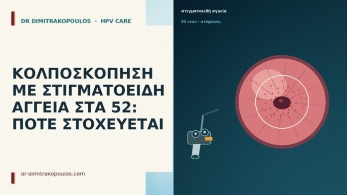 ΚΟΛΠΟΣΚΟΠΗΣΗ ΜΕ ΣΤΙΓΜΑΤΟΕΙΔΗ ΑΓΓΕΙΑ ΣΤΑ 52: ΠΟΤΕ ΣΤΟΧΕΥΕΤΑΙ ΚΟΛΠΟΣΚΟΠΗΣΗ ΜΕ ΣΤΙΓΜΑΤΟΕΙΔΗ ΑΓΓΕΙΑ ΣΤΑ 52: ΠΟΤΕ ΣΤΟΧΕΥΕΤΑΙ