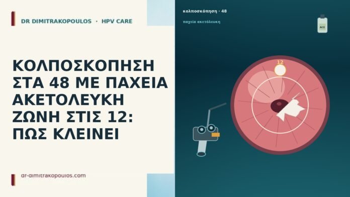 ΚΟΛΠΟΣΚΟΠΗΣΗ ΣΤΑ 48 ΜΕ ΠΑΧΕΙΑ ΑΚΕΤΟΛΕΥΚΗ ΖΩΝΗ ΣΤΙΣ 12: ΠΩΣ