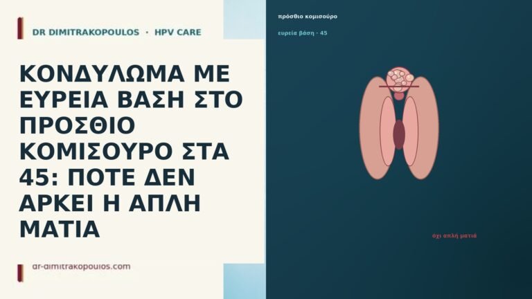 ΚΟΝΔΥΛΩΜΑ ΜΕ ΕΥΡΕΙΑ ΒΑΣΗ ΣΤΟ ΠΡΟΣΘΙΟ ΚΟΜΙΣΟΥΡΟ ΣΤΑ 45: ΠΟΤΕ
