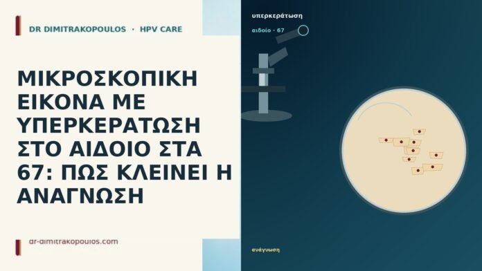 ΜΙΚΡΟΣΚΟΠΙΚΗ ΕΙΚΟΝΑ ΜΕ ΥΠΕΡΚΕΡΑΤΩΣΗ ΣΤΟ ΑΙΔΟΙΟ ΣΤΑ 67: ΠΩΣ ΚΛΕΙΝΕΙ Η ΑΝΑΓΝΩΣΗ ΜΙΚΡΟΣΚΟΠΙΚΗ ΕΙΚΟΝΑ ΜΕ ΥΠΕΡΚΕΡΑΤΩΣΗ ΣΤΟ ΑΙΔΟΙΟ ΣΤΑ 67: ΠΩΣ ΚΛΕΙΝΕΙ