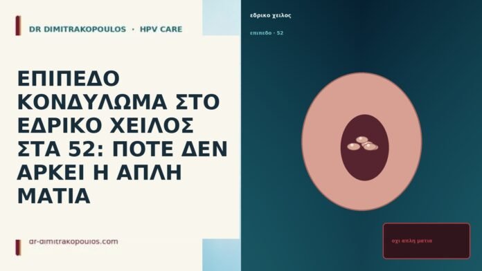 ΕΠΙΠΕΔΟ ΚΟΝΔΥΛΩΜΑ ΣΤΟ ΕΔΡΙΚΟ ΧΕΙΛΟΣ ΣΤΑ 52: ΠΟΤΕ ΔΕΝ ΑΡΚΕΙ Η ΑΠΛΗ ΜΑΤΙΑ ΕΠΙΠΕΔΟ ΚΟΝΔΥΛΩΜΑ ΣΤΟ ΕΔΡΙΚΟ ΧΕΙΛΟΣ ΣΤΑ 52: ΠΟΤΕ ΔΕΝ ΑΡΚΕΙ