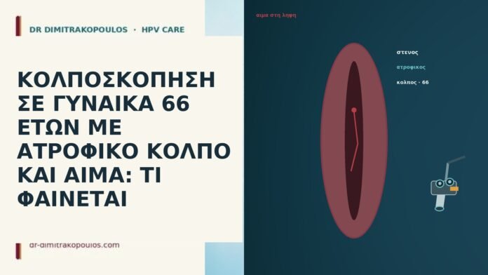 ΚΟΛΠΟΣΚΟΠΗΣΗ ΣΕ ΓΥΝΑΙΚΑ 66 ΕΤΩΝ ΜΕ ΑΤΡΟΦΙΚΟ ΚΟΛΠΟ ΚΑΙ ΑΙΜΑ: ΤΙ ΦΑΙΝΕΤΑΙ ΚΟΛΠΟΣΚΟΠΗΣΗ ΣΕ ΓΥΝΑΙΚΑ 66 ΕΤΩΝ ΜΕ ΑΤΡΟΦΙΚΟ ΚΟΛΠΟ ΚΑΙ ΑΙΜΑ: