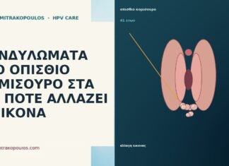 ΚΟΝΔΥΛΩΜΑΤΑ ΣΤΟ ΟΠΙΣΘΙΟ ΚΟΜΙΣΟΥΡΟ ΣΤΑ 41: ΠΟΤΕ ΑΛΛΑΖΕΙ Η ΕΙΚΟΝΑ