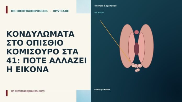 ΚΟΝΔΥΛΩΜΑΤΑ ΣΤΟ ΟΠΙΣΘΙΟ ΚΟΜΙΣΟΥΡΟ ΣΤΑ 41: ΠΟΤΕ ΑΛΛΑΖΕΙ Η ΕΙΚΟΝΑ
