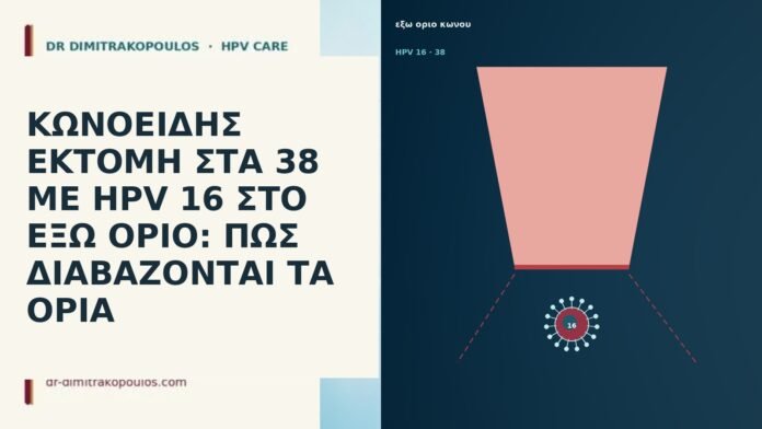 ΚΩΝΟΕΙΔΗΣ ΕΚΤΟΜΗ ΣΤΑ 38 ΜΕ HPV 16 ΣΤΟ ΕΞΩ ΟΡΙΟ: ΠΩΣ ΔΙΑΒΑΖΟΝΤΑΙ ΤΑ ΟΡΙΑ ΚΩΝΟΕΙΔΗΣ ΕΚΤΟΜΗ ΣΤΑ 38 ΜΕ HPV 16 ΣΤΟ ΕΞΩ ΟΡΙΟ: