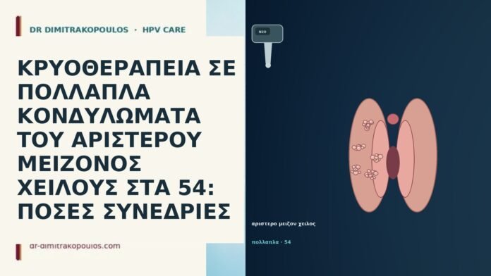 ΚΡΥΟΘΕΡΑΠΕΙΑ ΣΕ ΠΟΛΛΑΠΛΑ ΚΟΝΔΥΛΩΜΑΤΑ ΤΟΥ ΑΡΙΣΤΕΡΟΥ ΜΕΙΖΟΝΟΣ ΧΕΙΛΟΥΣ ΣΤΑ 54: ΠΟΣΕΣ ΣΥΝΕΔΡΙΕΣ ΚΡΥΟΘΕΡΑΠΕΙΑ ΣΕ ΠΟΛΛΑΠΛΑ ΚΟΝΔΥΛΩΜΑΤΑ ΤΟΥ ΑΡΙΣΤΕΡΟΥ ΜΕΙΖΟΝΟΣ ΧΕΙΛΟΥΣ ΣΤΑ 54: