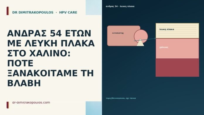 ΑΝΔΡΑΣ 54 ΕΤΩΝ ΜΕ ΛΕΥΚΗ ΠΛΑΚΑ ΣΤΟ ΧΑΛΙΝΟ: ΠΟΤΕ ΞΑΝΑΚΟΙΤΑΜΕ