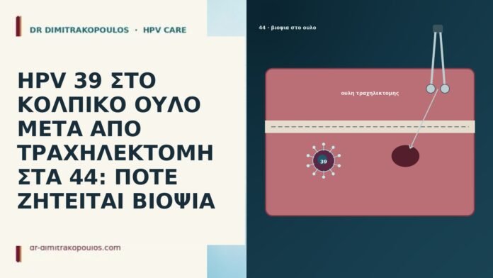 HPV 39 ΣΤΟ ΚΟΛΠΙΚΟ ΟΥΛΟ ΜΕΤΑ ΑΠΟ ΤΡΑΧΗΛΕΚΤΟΜΗ ΣΤΑ 44: ΠΟΤΕ ΖΗΤΕΙΤΑΙ ΒΙΟΨΙΑ HPV 39 ΣΤΟ ΚΟΛΠΙΚΟ ΟΥΛΟ ΜΕΤΑ ΑΠΟ ΤΡΑΧΗΛΕΚΤΟΜΗ ΣΤΑ 44: