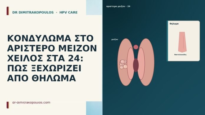 ΚΟΝΔΥΛΩΜΑ ΣΤΟ ΑΡΙΣΤΕΡΟ ΜΕΙΖΟΝ ΧΕΙΛΟΣ ΣΤΑ 24: ΠΩΣ ΞΕΧΩΡΙΖΕΙ ΑΠΟ